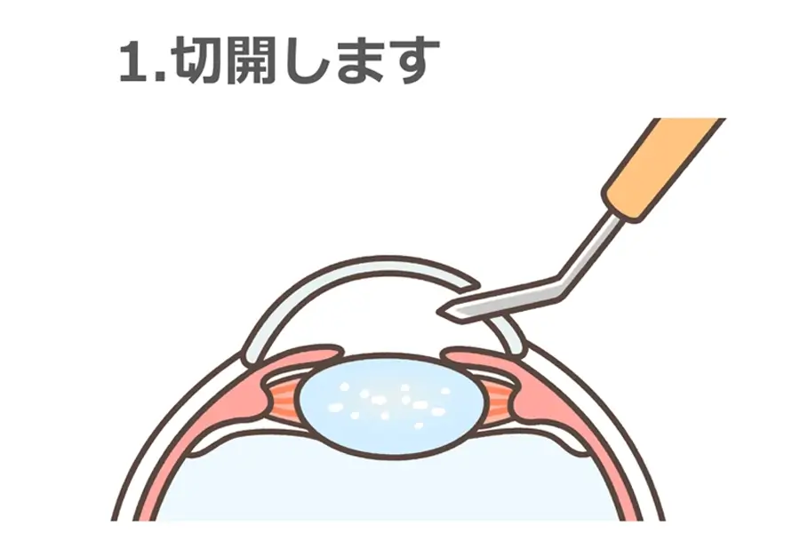 1.切開します